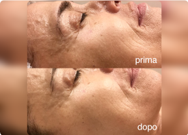 Centro specializzato in trattamenti anti-età a Prato